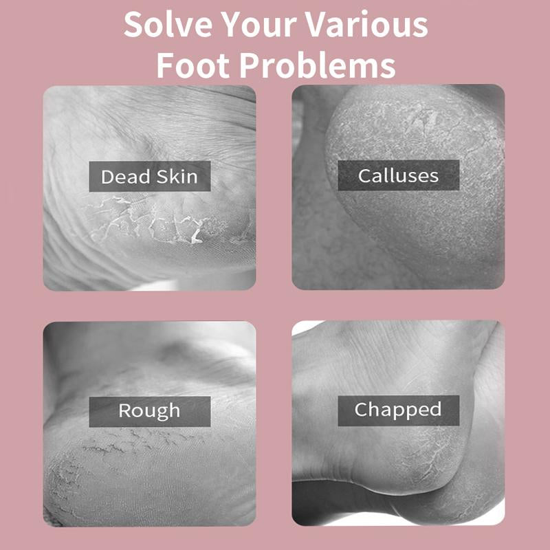 Varolan Electric Foot Grinder, Rechargeable Foot Callus Remover, Electric Foot Callus Remover Kit Foot File, Cordless Pedicure Machine, Portable Foot Files Cleaning Tool for Home and Travel, Mother'S Day Gift, Valentine'S Day Gift