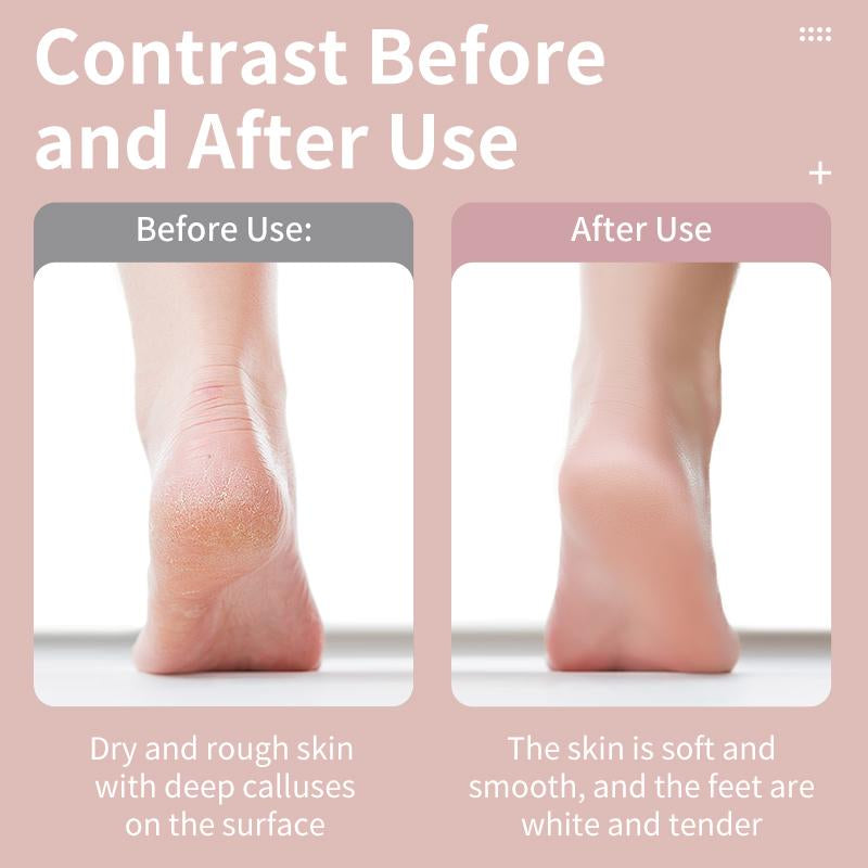 Varolan Electric Foot Grinder, Rechargeable Foot Callus Remover, Electric Foot Callus Remover Kit Foot File, Cordless Pedicure Machine, Portable Foot Files Cleaning Tool for Home and Travel, Mother'S Day Gift, Valentine'S Day Gift