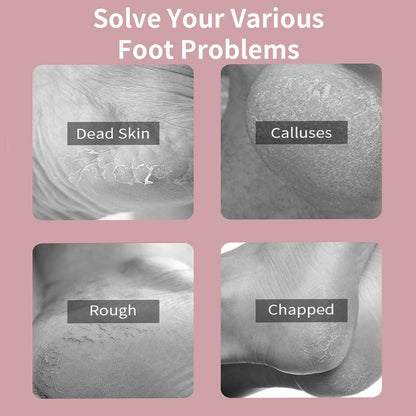 Varolan Electric Foot Grinder, Rechargeable Foot Callus Remover, Electric Foot Callus Remover Kit Foot File, Cordless Pedicure Machine, Portable Foot Files Cleaning Tool for Home and Travel, Mother'S Day Gift, Valentine'S Day Gift